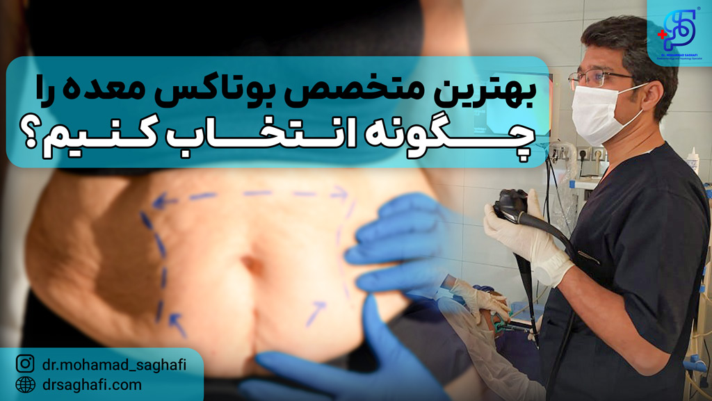 بهترین دکتر بوتاکس معده در تهران را چگونه انتخاب کنیم؟