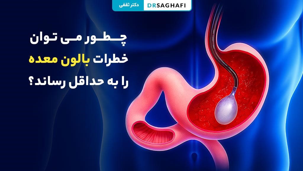 چطور می توان خطرات بالون معده را به حداقل رساند؟