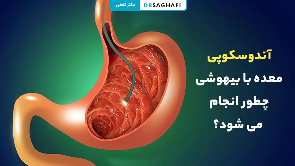 آندوسکوپی معده با بیهوشی چطور انجام می شود؟