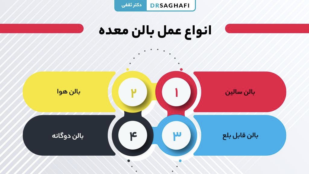 انواع عمل بالن معده