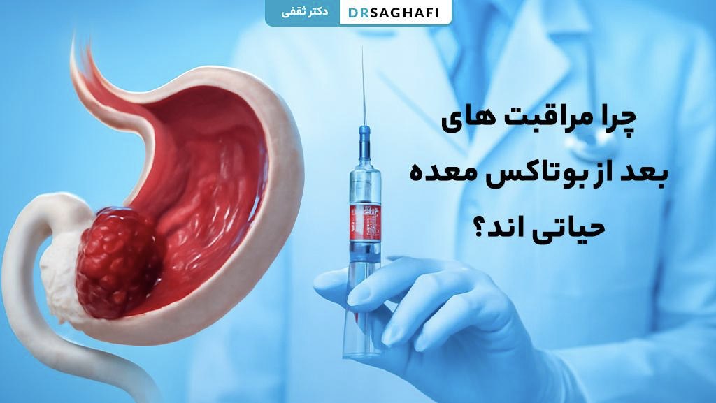 چرا مراقبت های بعد از بوتاکس معده حیاتی اند؟