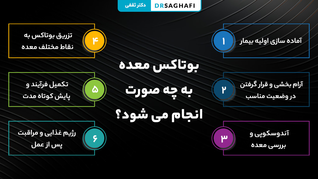 مراحل بوتاکس معده