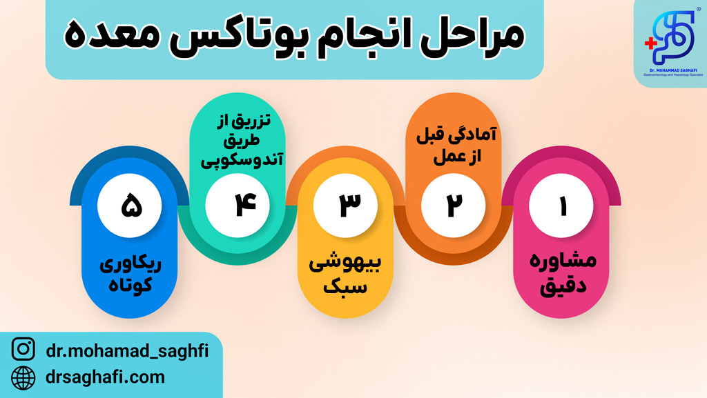 مراحل انجام بوتاکس معده
