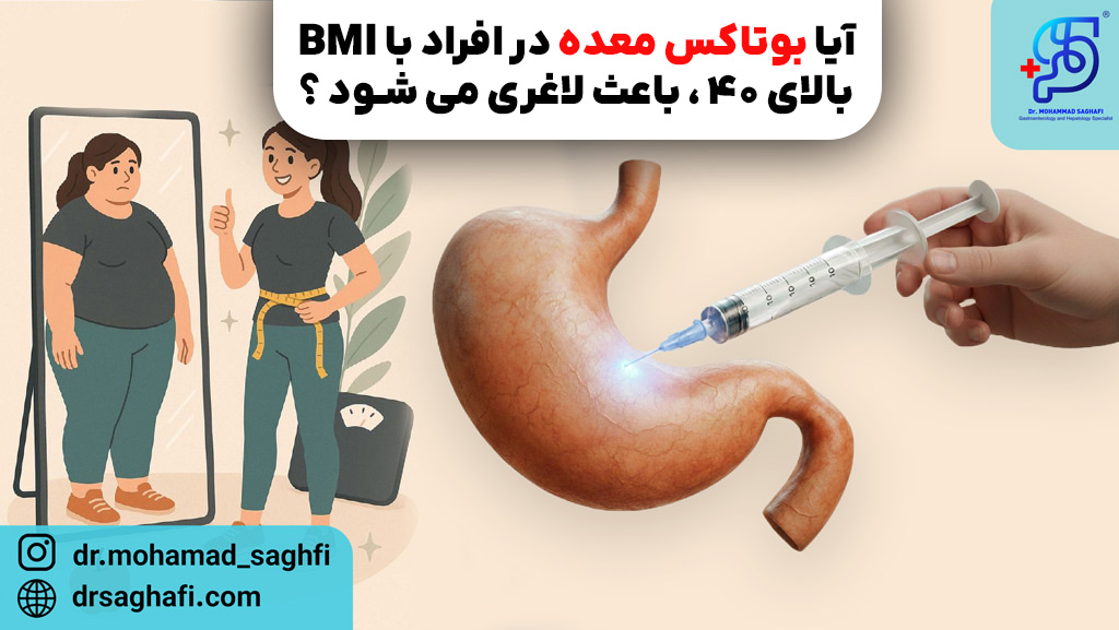 آیا بوتاکس معده در افراد با BMI بالای 40، باعث لاغری می شود؟