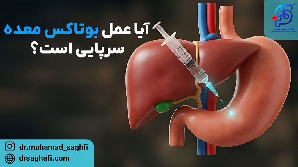 آیا عمل بوتاکس معده سرپایی است؟