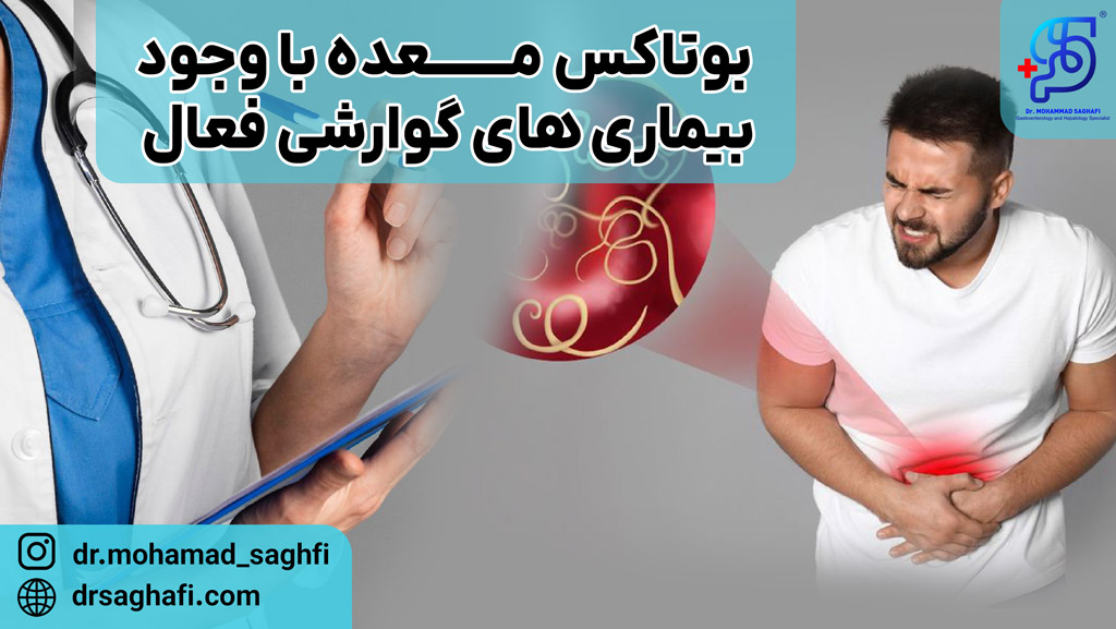  بوتاکس معده با وجود بیماری های گوارشی فعال