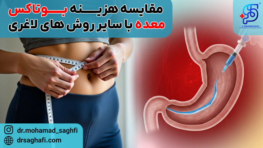 مقایسه هزینه بوتاکس معده با سایر روش های لاغری