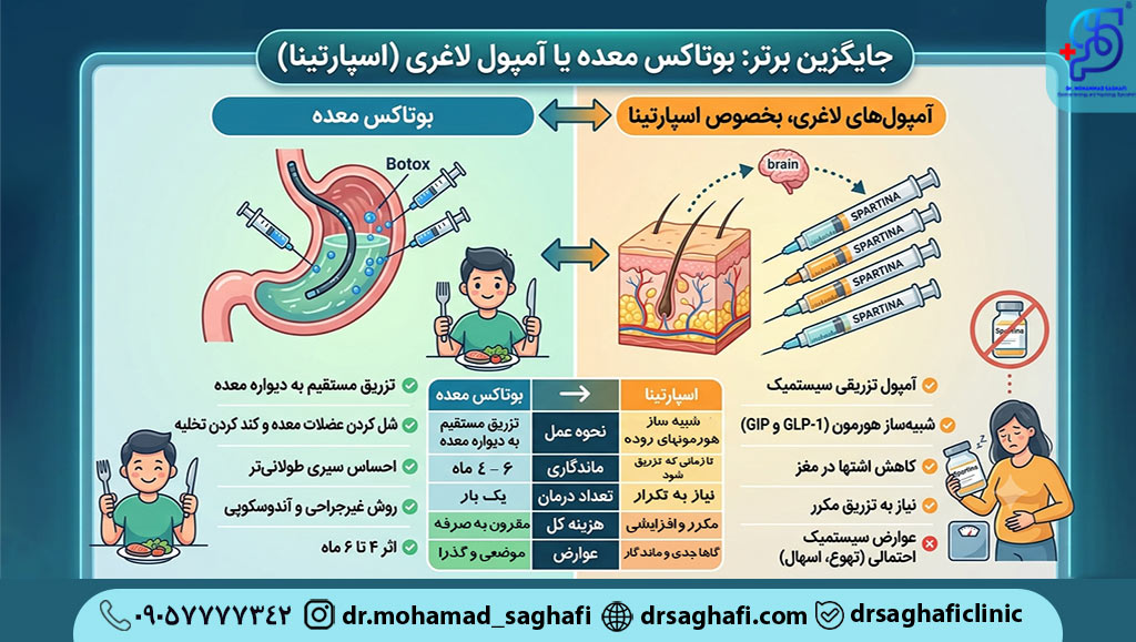 بوتاکس معده بهترین جایگزین اسپارتینا