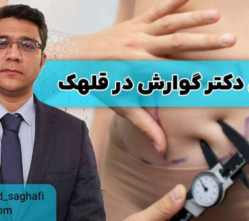 بهترین دکتر گوارش در قلهک
