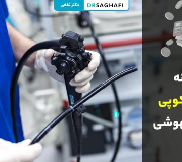 هزینه آندوسکوپی بدون بیهوشی