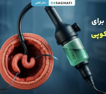 آمادگی برای آندوسکوپی [مراحل و نکات مهم قبل از آندوسکوپی]