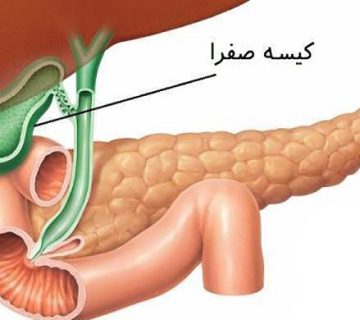 بیماری های مجاری صفراوی