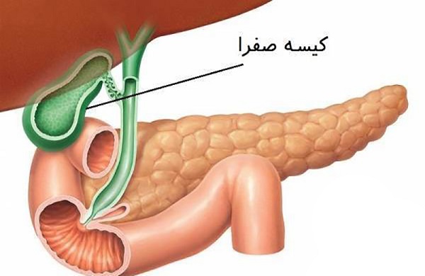 بیماری های مجاری صفراوی