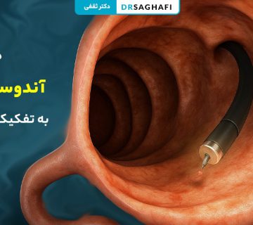 هزینه آندوسکوپی