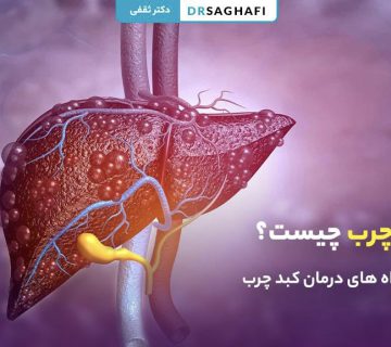 کبد چرب چیست؟ بهترین راه های درمان کبد چرب