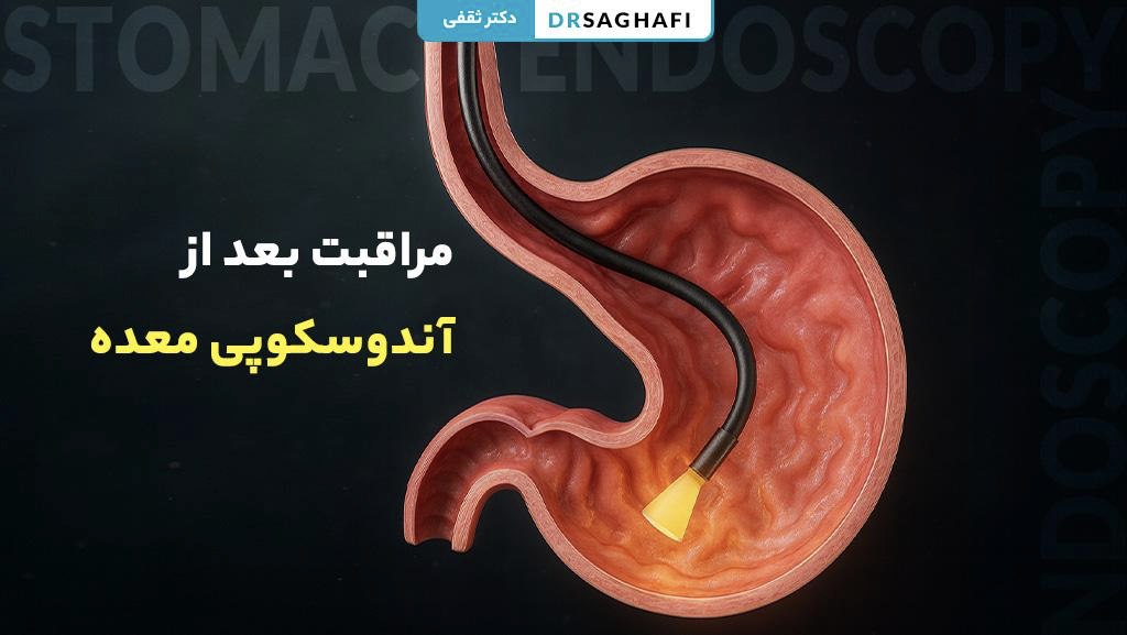 مراقبت بعد از آندوسکوپی معده