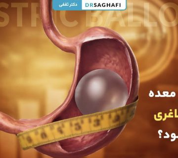 آیا بالن معده باعث لاغری می شود؟