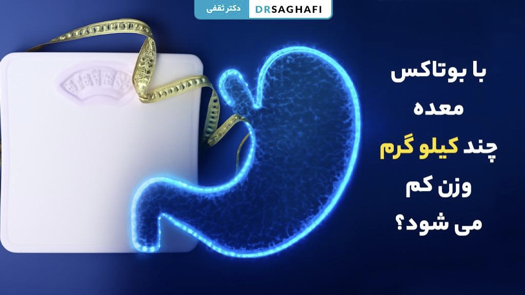 بوتاکس معده چند کیلو گرم وزن کم میکنی