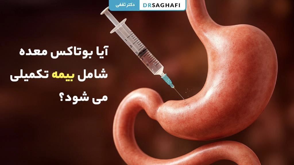 آیا بوتاکس معده شامل بیمه تکمیلی می شود؟