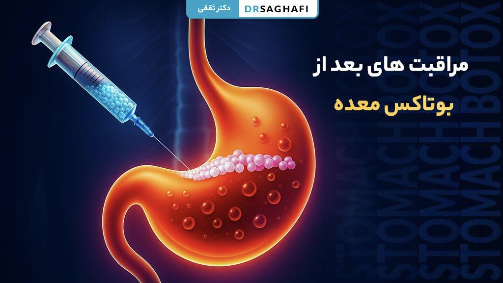مراقبت های بعد از بوتاکس معده
