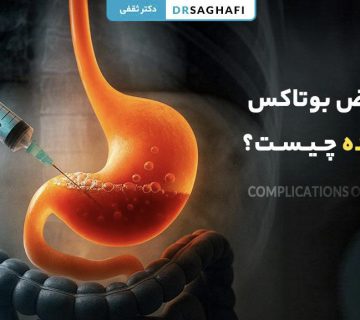 عوارض بوتاکس معده