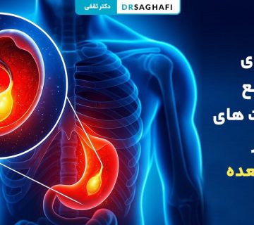 مراقبت های بعد از بالن معده