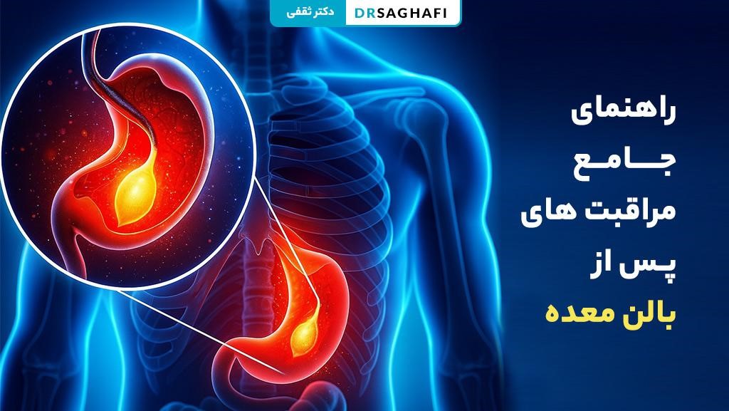 مراقبت های بعد از بالن معده