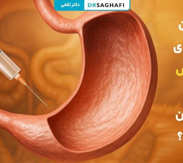 بهترین دکتر بوتاکس معده در تهران