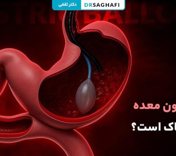 آیا بالون معده خطرناک است؟