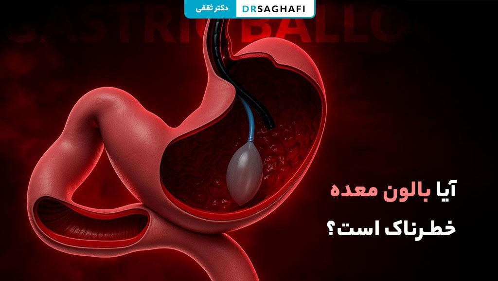 آیا بالون معده خطرناک است؟