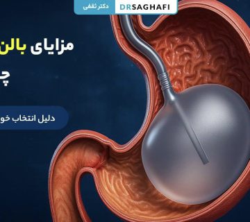 مزایای بالن معده چیست؟