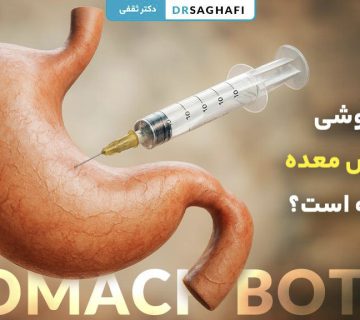 بیهوشی بوتاکس معده چگونه است؟ روش‌های انجام + مراقبت‌ها