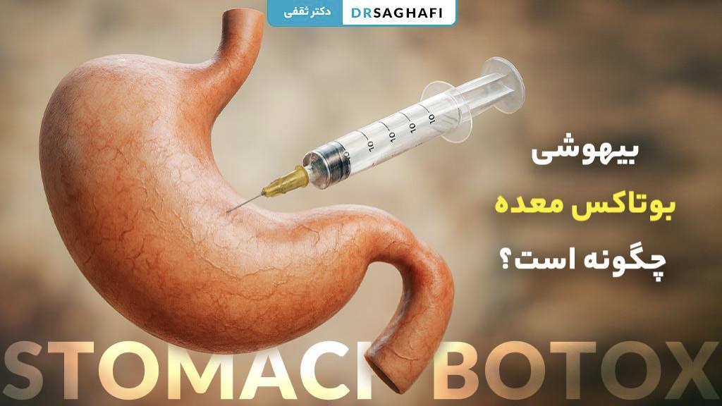بیهوشی بوتاکس معده چگونه است؟ روش‌های انجام + مراقبت‌ها