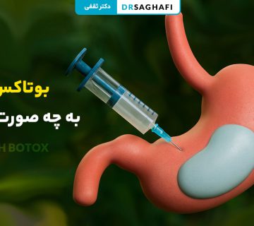 بوتاکس معده به چه صورت است؟