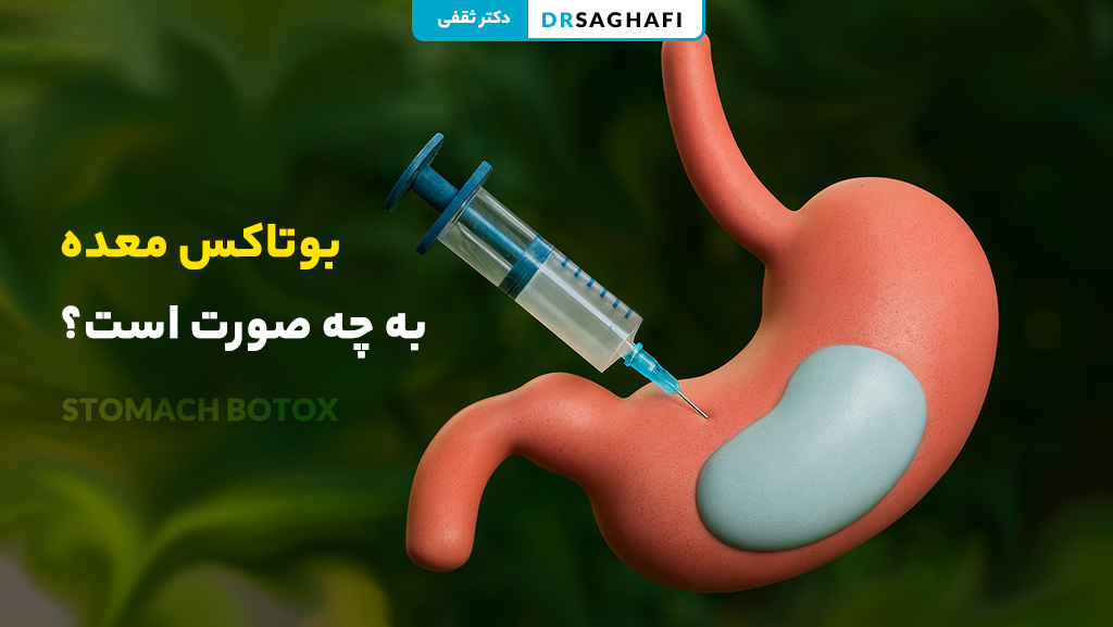 بوتاکس معده به چه صورت است؟
