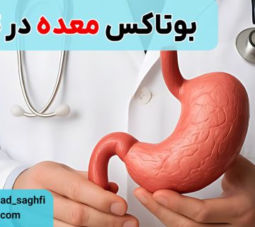 بوتاکس معده در تهران