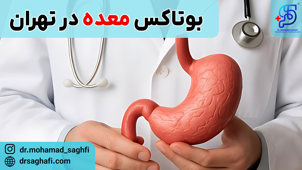 بوتاکس معده در تهران