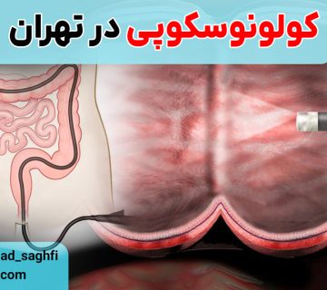 کولونوسکوپی در تهران