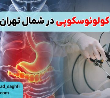 کولونوسکوپی در شمال تهران