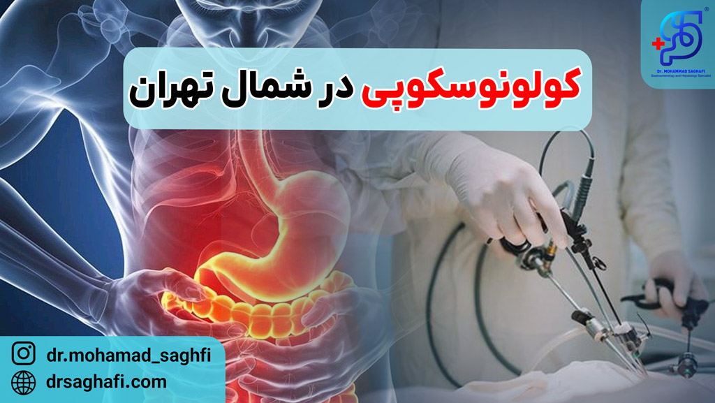 کولونوسکوپی در شمال تهران