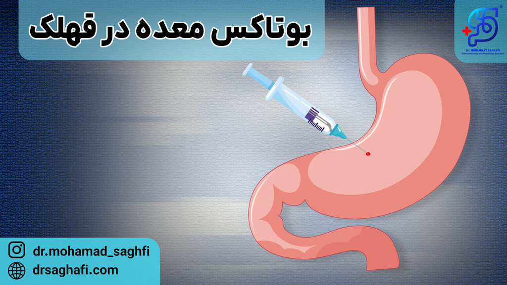 بوتاکس معده در قهلک