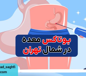 بوتاکس معده در شمال تهران