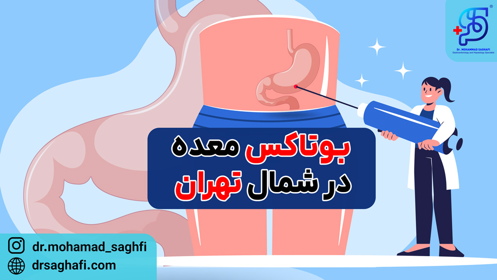 بوتاکس معده در شمال تهران