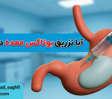 آیا تزریق بوتاکس معده درد دارد؟