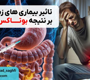 تاثیر بیماری های زمینه ای بر نتیجه بوتاکس معده چگونه است؟