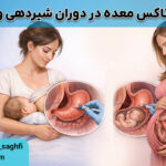 بوتاکس معده در دوران شیردهی و بارداری