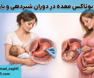 بوتاکس معده در دوران شیردهی و بارداری