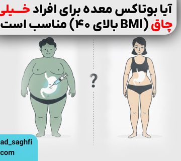 بوتاکس معده برای چاقی مفرط (BMI بالای 40)
