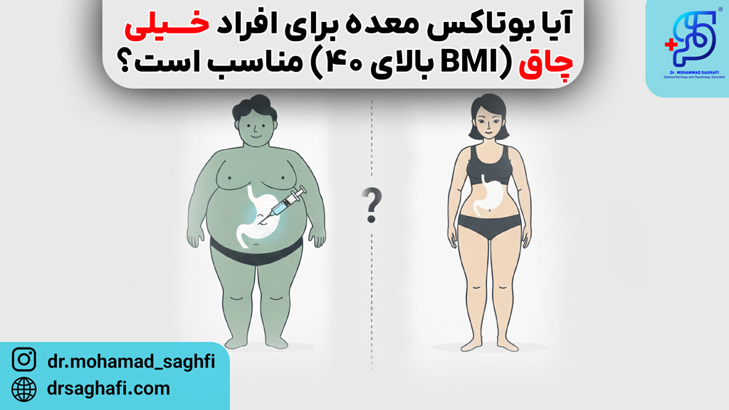 بوتاکس معده برای چاقی مفرط (BMI بالای 40)