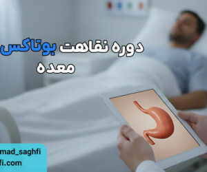 دوره نقاهت بوتاکس معده